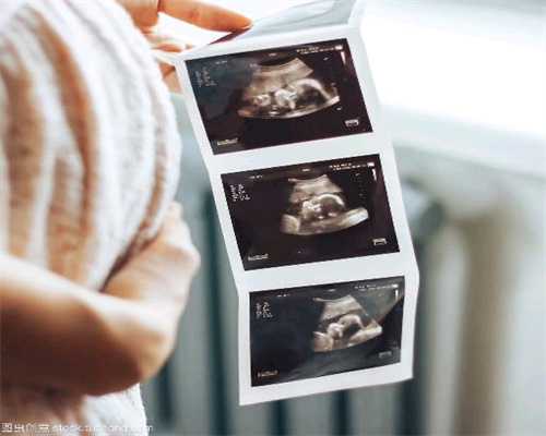 成都2022代孕孩子-助孕电话_正规捐卵有报酬去泰国做试管婴儿要多少钱？